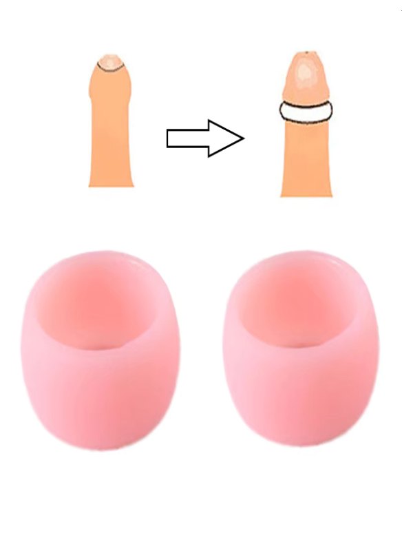 Lesparty Foreskin Correction Penis Ring Set - Passionzone Adult Store