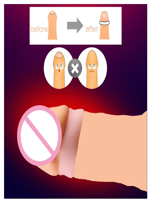 Lesparty Foreskin Correction Penis Ring Set - Passionzone Adult Store